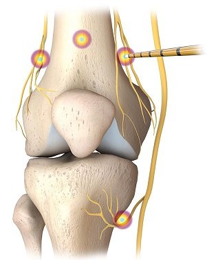 SERVICES Expedium Orthopaedics